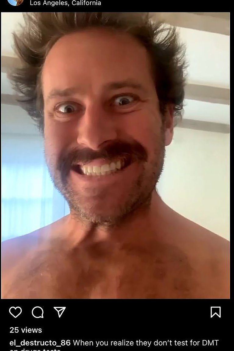 Las fotos de Armie Hammer en redes sociales fueron motivo de alarma al quedar descubierta su oculta pasión por el canibalismo.