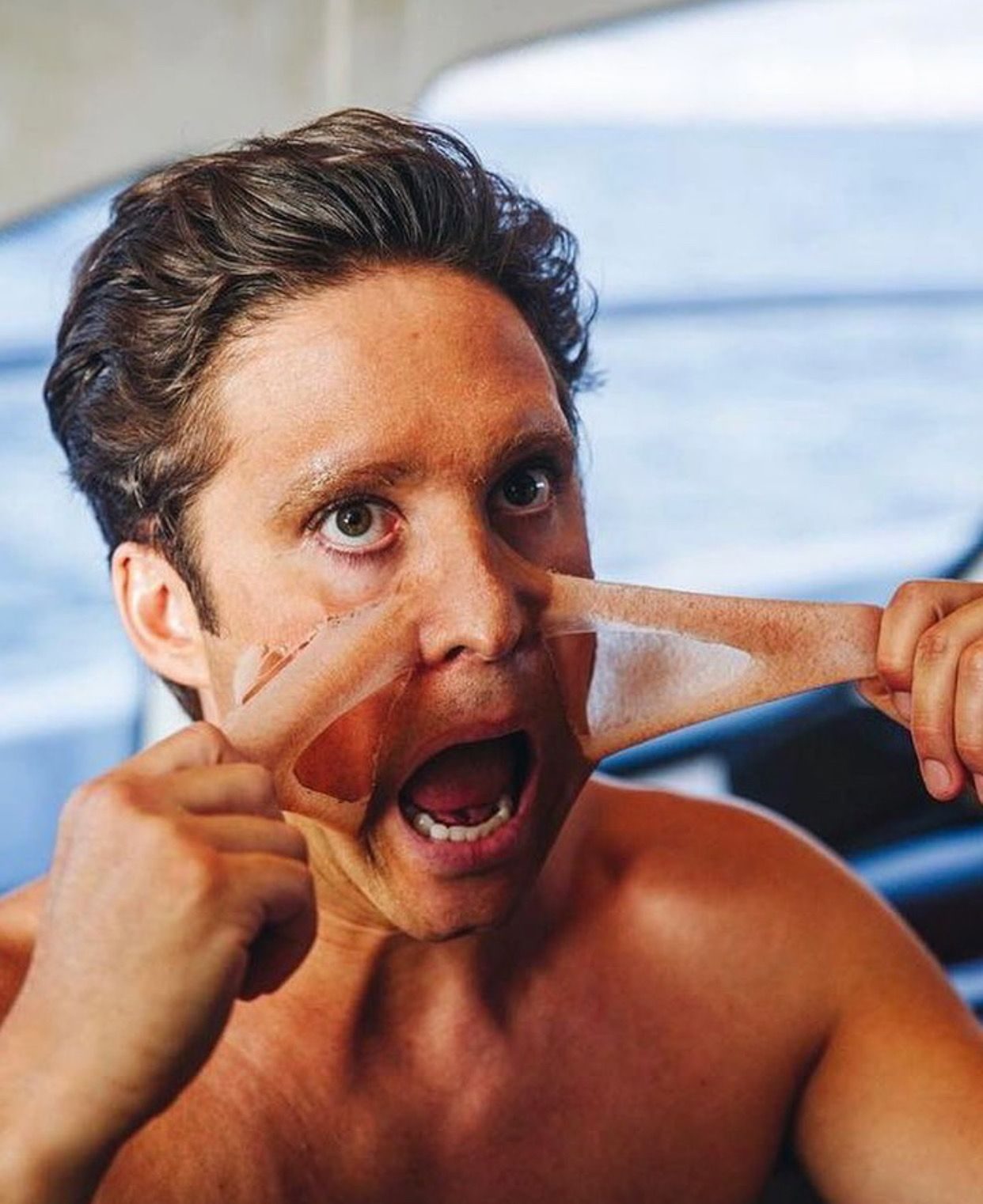 Diego-Boneta-prostéticos