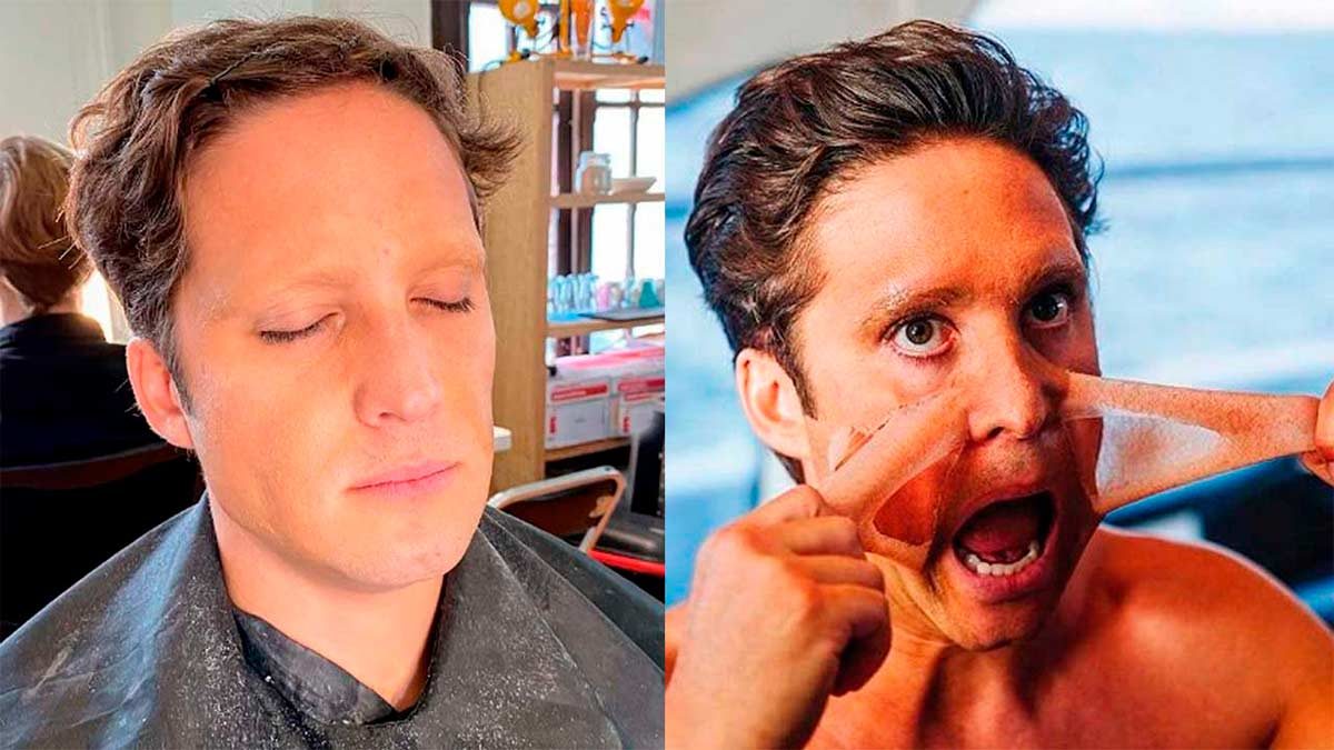 Diego-Boneta-prosteticos