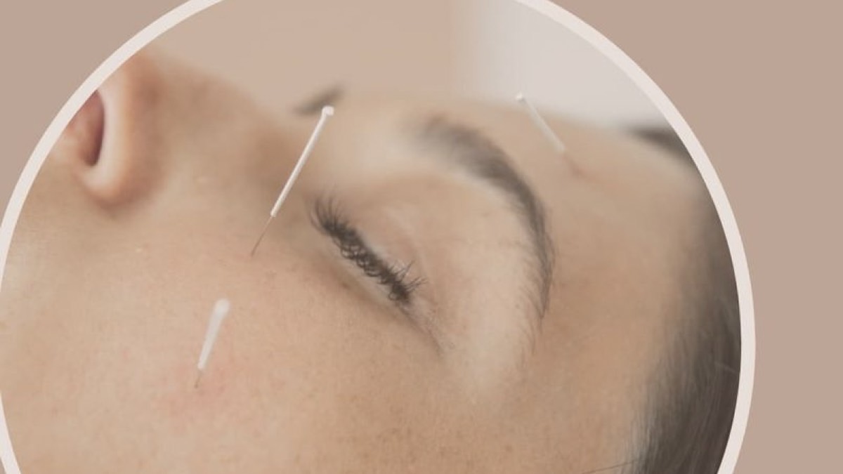 “The Body Clinic” es una clínica de acupuntura estética facial y corporal
