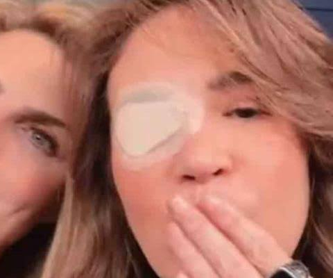 Yolanda Andrade reveló la razón por la que tiene que usar un parche en el ojo izquierdo.