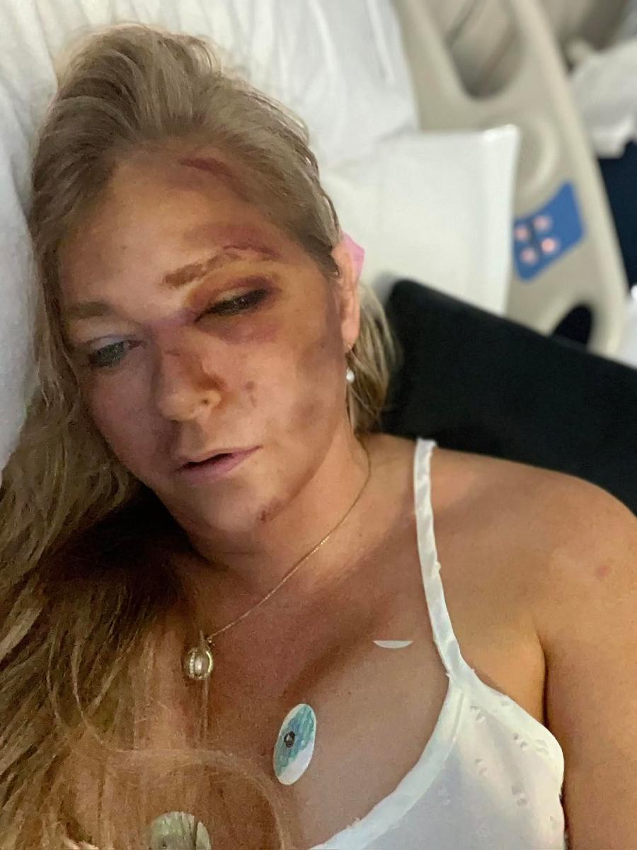 Virginia Giuffre impactó con esta imagen publicada en sus redes sociales.