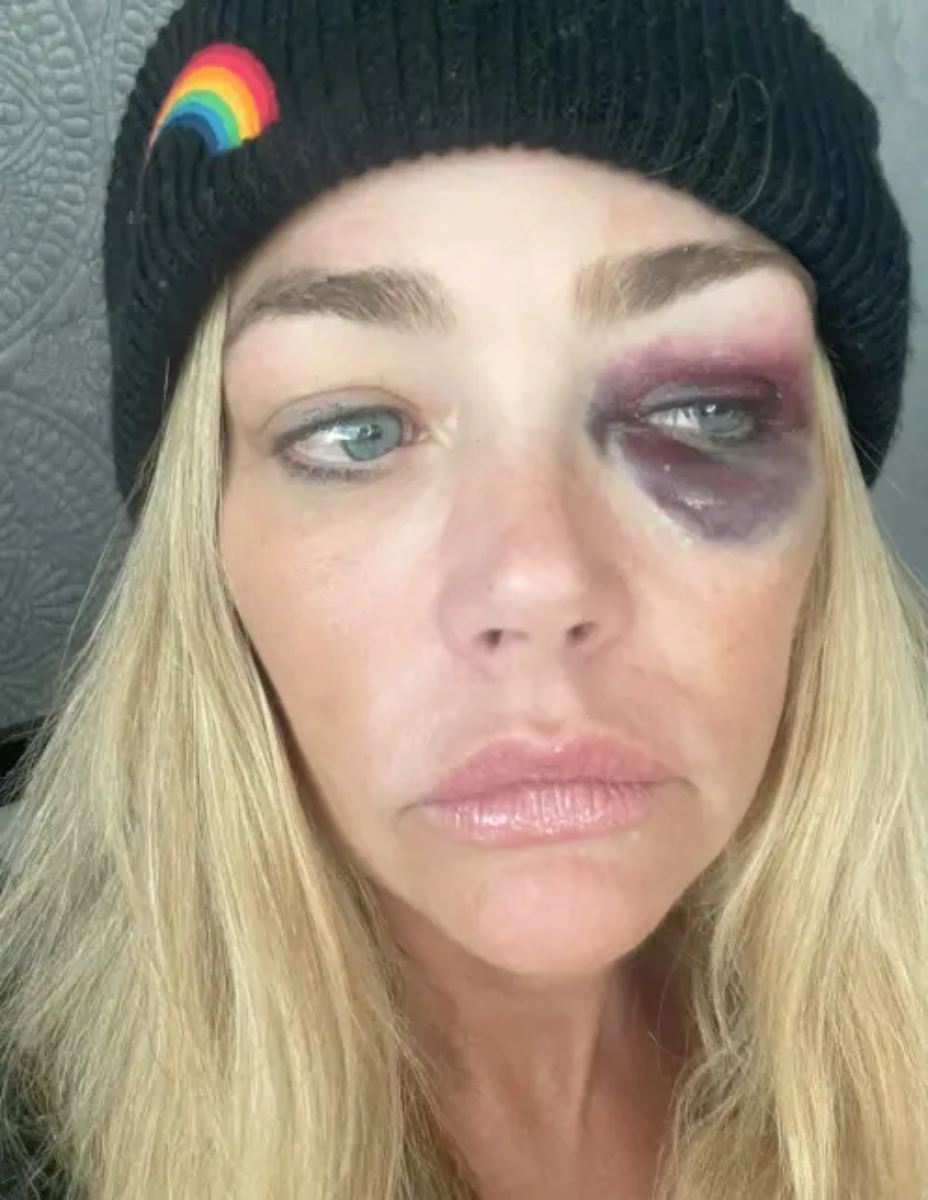 Denise Richards acusó de ser víctima de violencia por parte de su esposo.