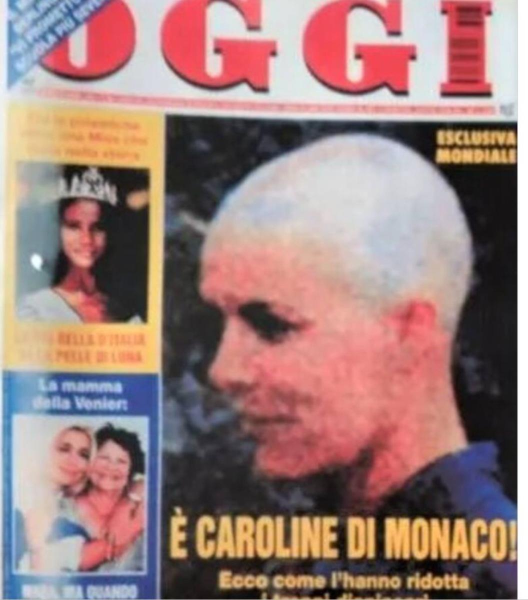 La revista italiana Oggi reveló la imagen de la princesa Carolina con la cabeza rapada.